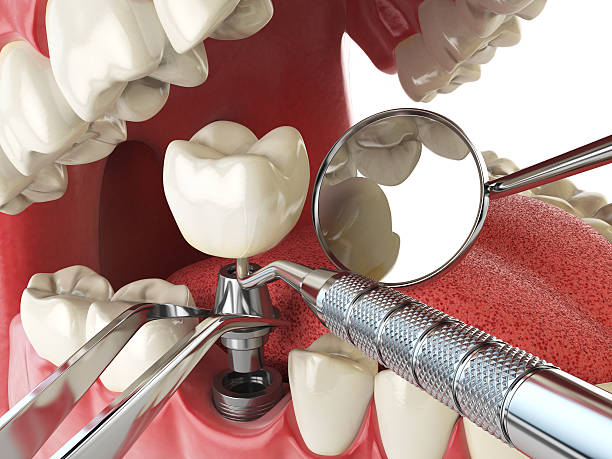 Best Emergency Care for Gum Disease in Seeley, CA